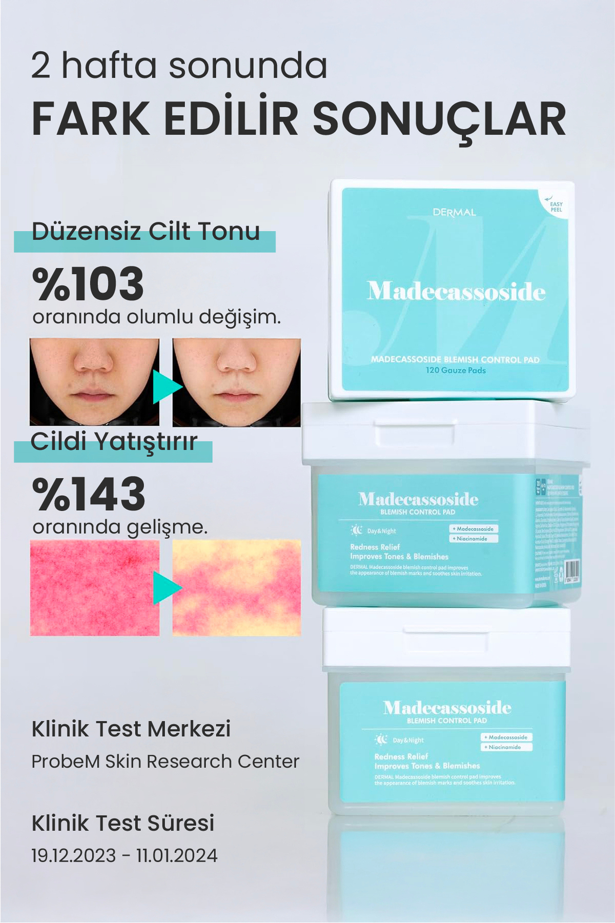 Madecassoside Yatıştırıcı Leke Kontrol Tonik Pedi 12 Adet Cilt Bakım ve Ton Eşitleyici Yüz Pedi — DERMAL/PAD/011 — تصویر 3 از 8
