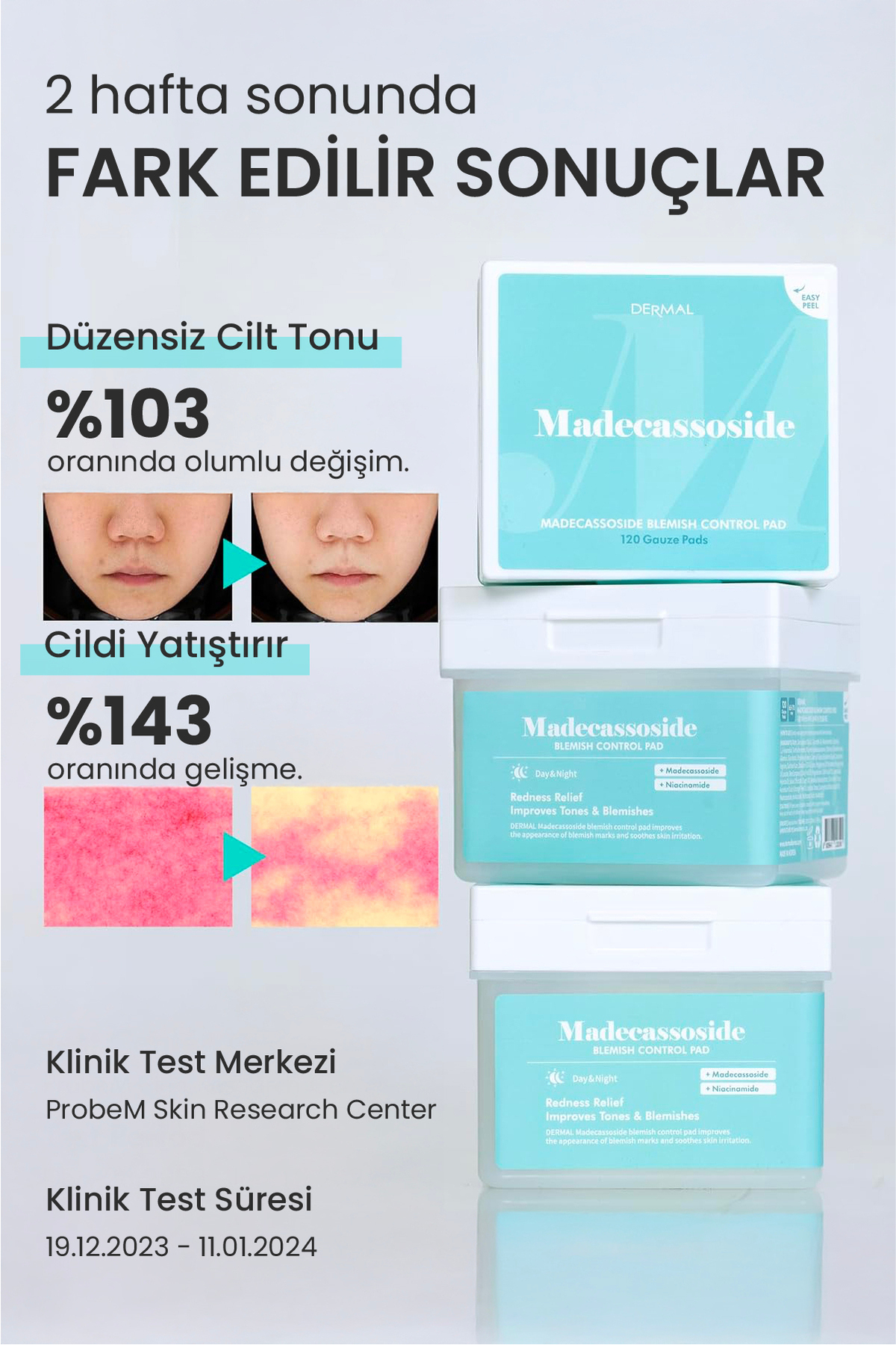 Madecassoside Blemish Control Pad Tonik Ped Gözenek Arındırıcı Karşıtı Toner Pad 120 Adet — DERMAL/PAD/007 — تصویر 4 از 9
