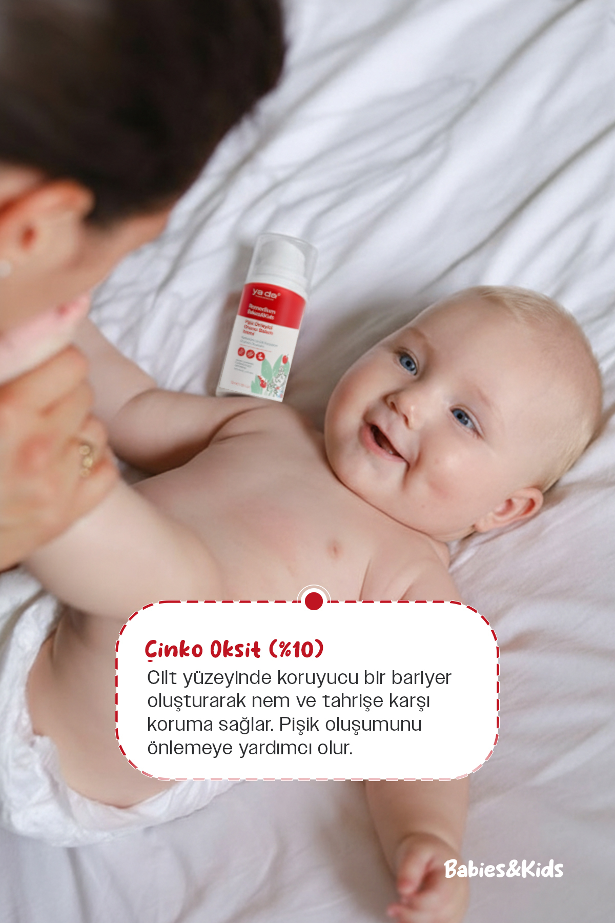 ya da multicosmetics Remedium Babies & Kids Pişik Önleyici Onarıcı Bakım Kremi, %10 Çinko İçerikli, Vegan, 50 ml fotoğrafı 4 (önizleme)