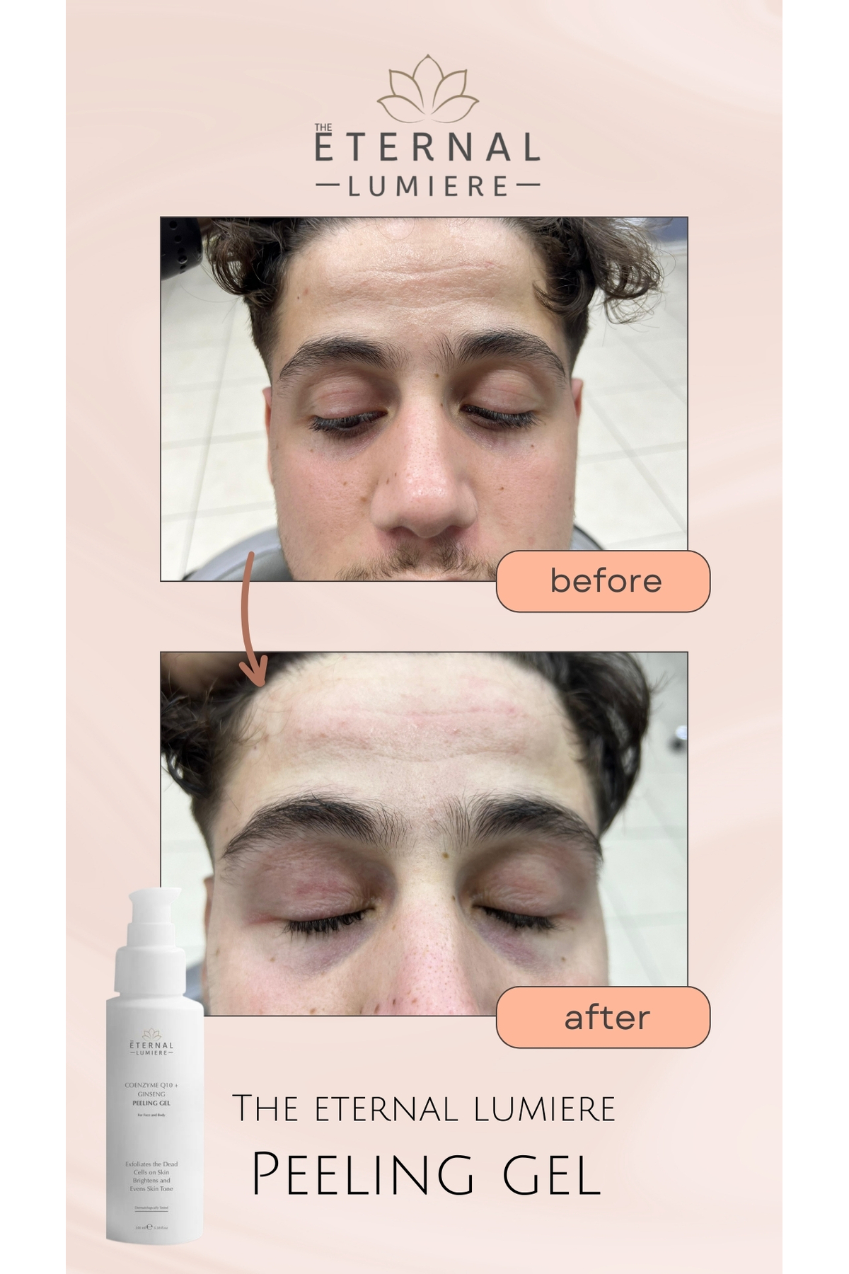 Yüz ve Vücut Cilt Peeling Temizlileme Jeli Coenzym Q10 & Giseng — THEETERNAL001 — تصویر 3 از 5