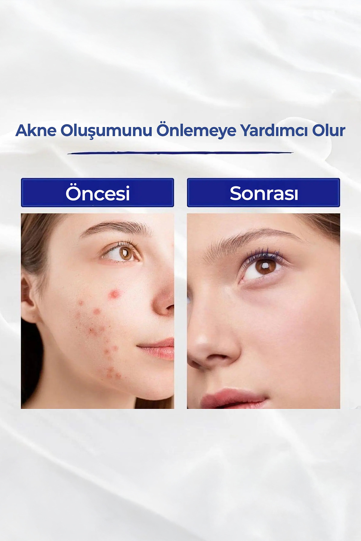 کرم رتینول ضد پیری و ضد چروک ویتامین A، 50 گرم — 102 — تصویر 6 از 8