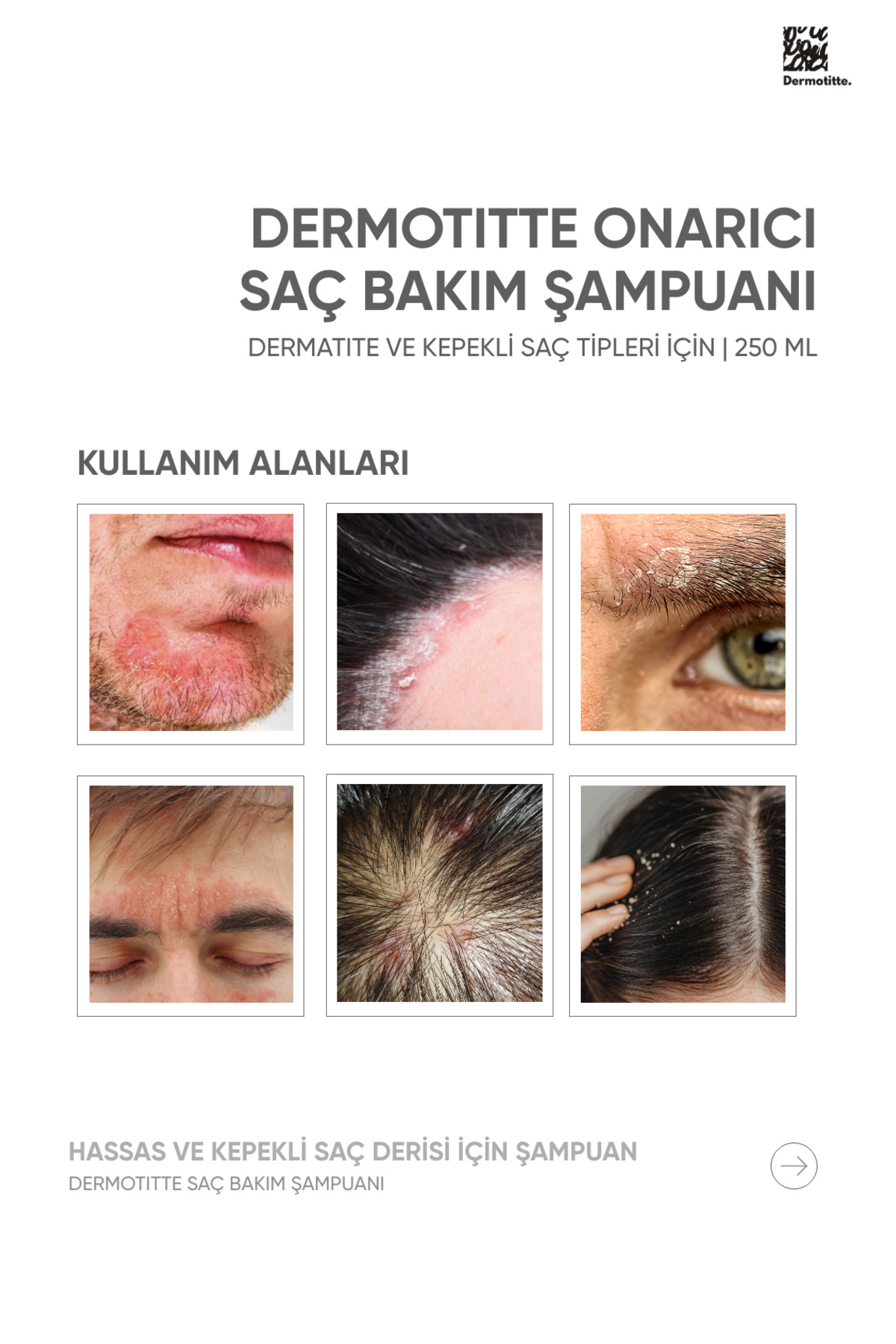 Dermotitte Bariyer Onarım Seti | Saç Bakım Şampuanı 250 ml + Onarıcı Krem — Avantajlıpaket — تصویر 3 از 8