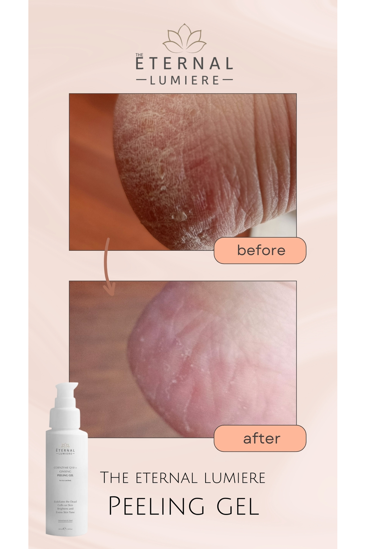 Yüz ve Vücut Cilt Peeling Temizlileme Jeli Coenzym Q10 & Giseng — THEETERNAL001 — تصویر 4 از 5