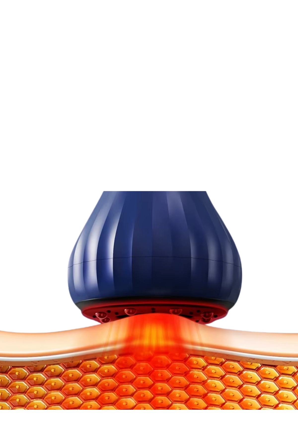 Epilons 008 Hacamat fotoğrafı 5 (önizleme)