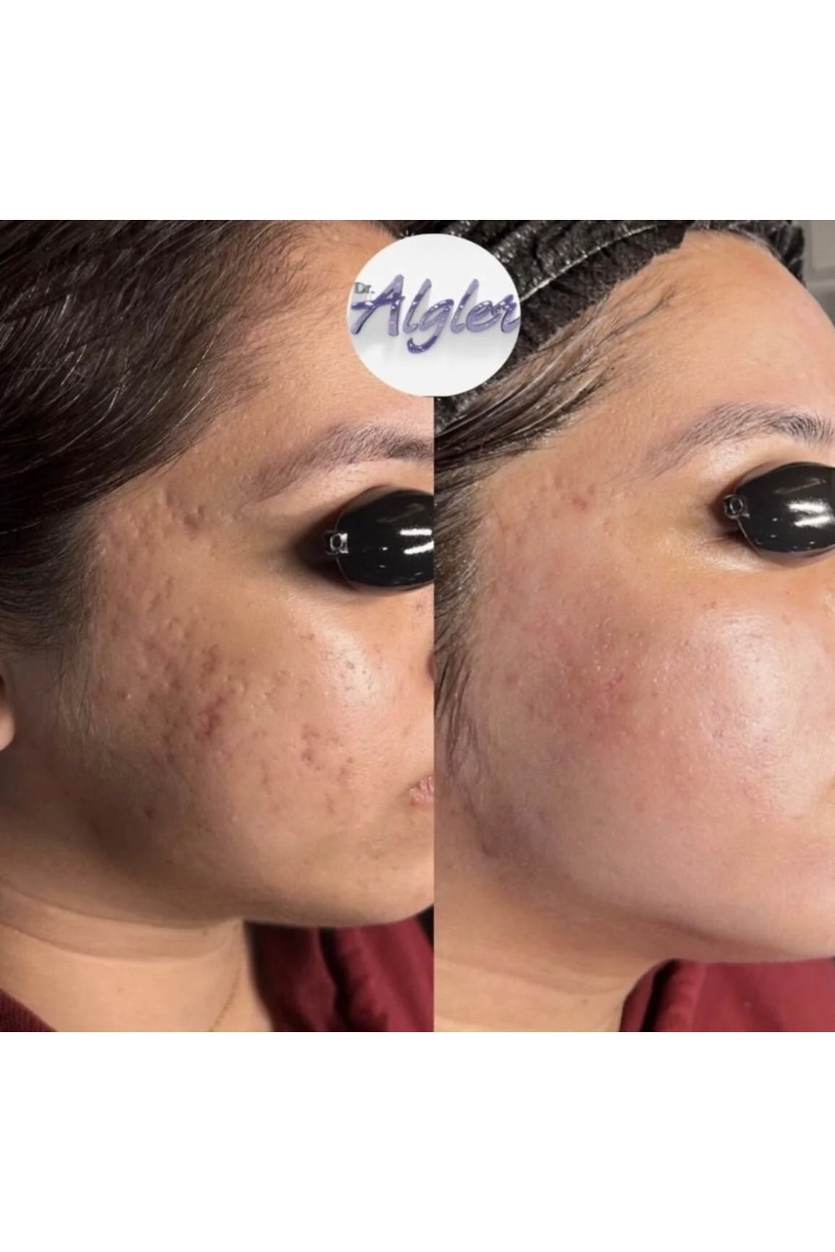 Dr algler yosun peelıng - g5 masaj yağı hedıyelı 250 ml — 055 — تصویر 5 از 5