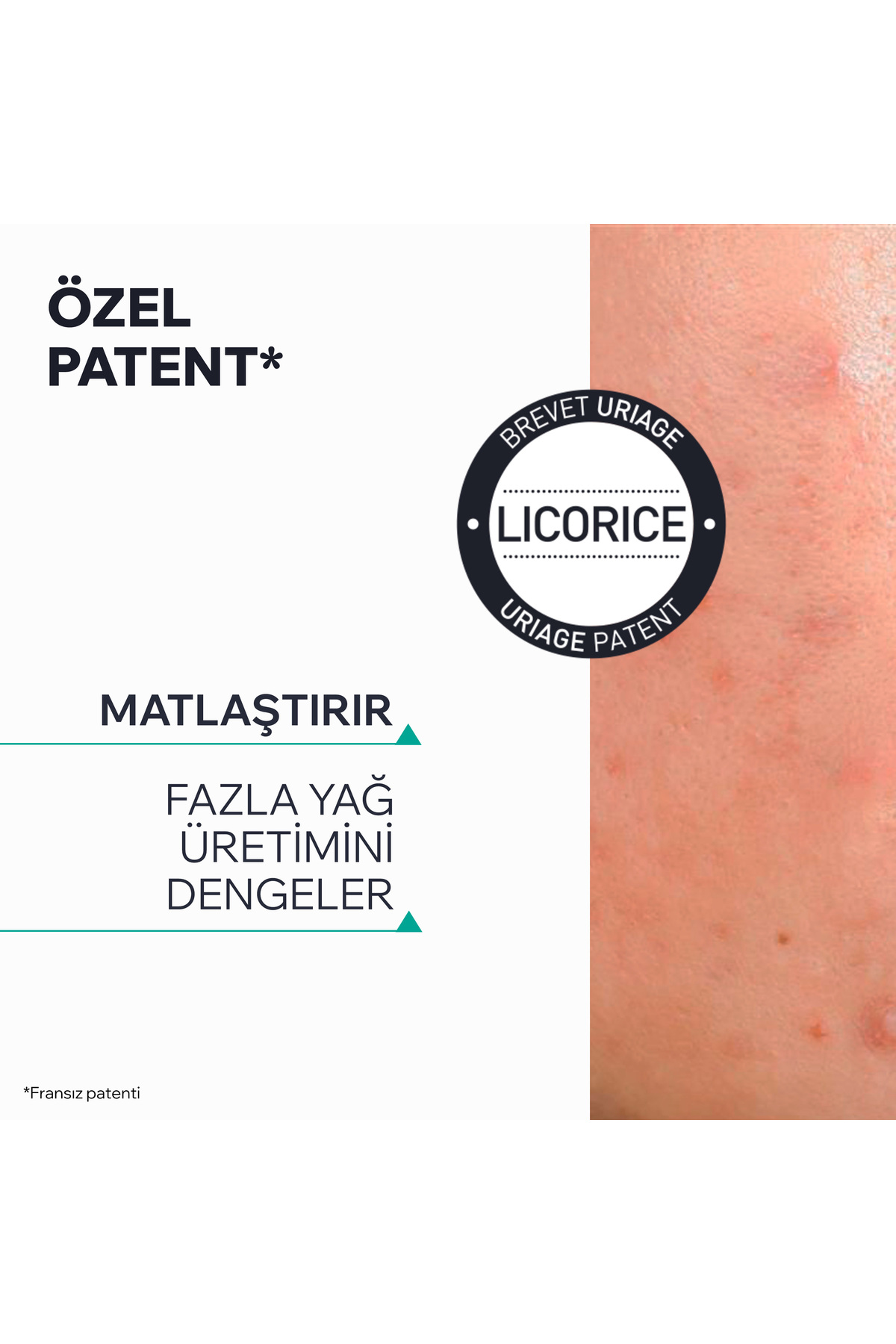 HYSEAC Mat Karma ve Yağlı Ciltler İçin Matlaştırıcı Emulsiyon 40 ml — 3661434010033 — تصویر 4 از 8