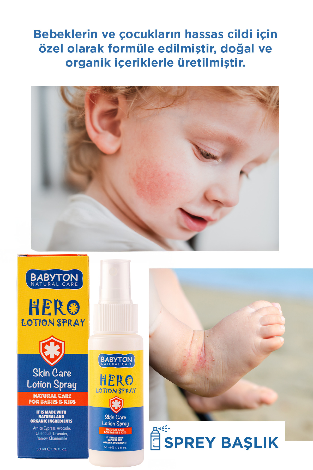 BABYTON Anlık Yatıştırıcı Hero Losyon Sprey 50 ml fotoğrafı 2 (önizleme)
