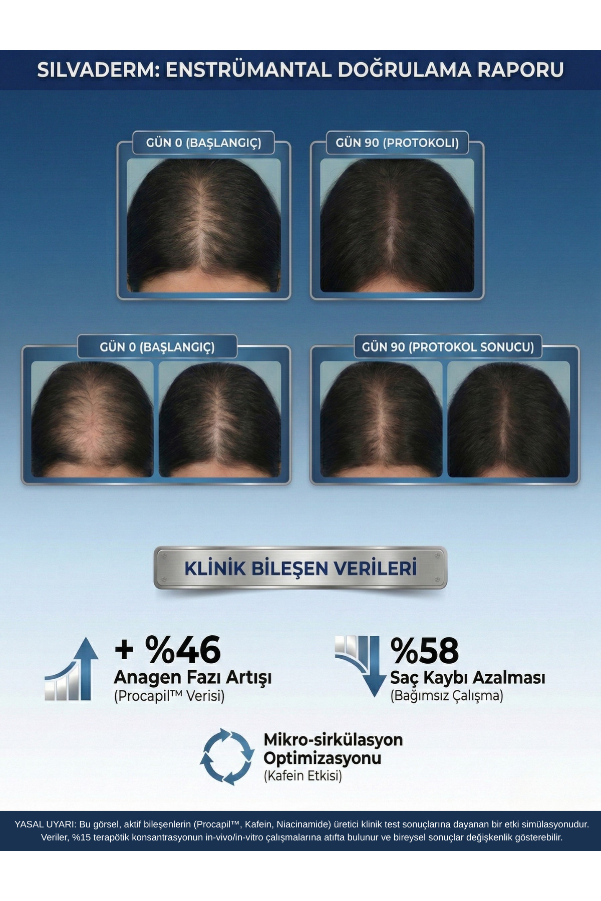 Silvaderm Yoğun Içerikli Saç Bakım Serumu — AlopeGen — تصویر 5 از 5