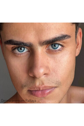 dermasuction Derma premium P. Blue 1 Yıllık 12 Ay Kullanım Süreli Göz Lensi