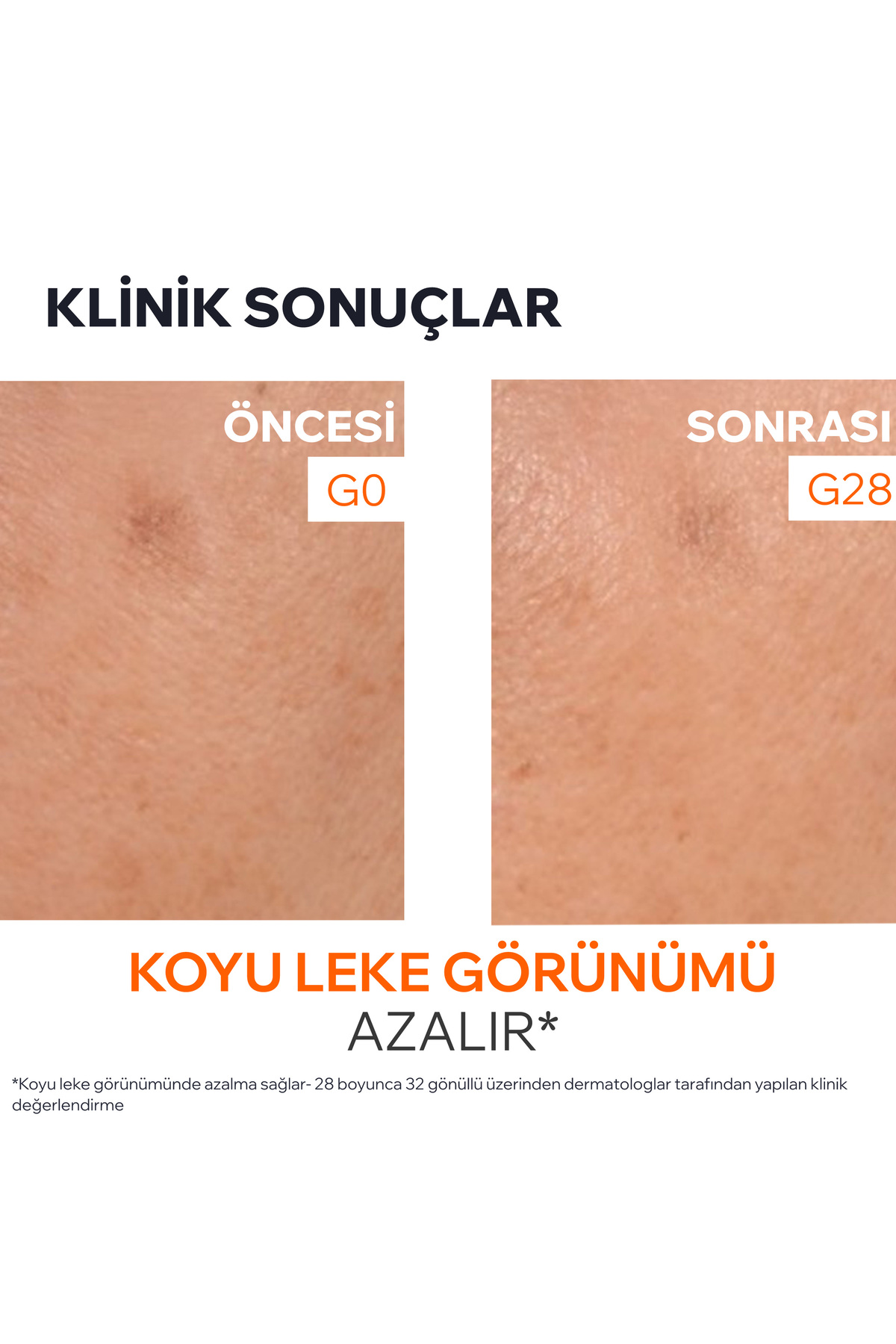 DEPIDERM Leke Karşıtı Aydınlatıcı Serum 30 ml — D80768 — تصویر 5 از 8