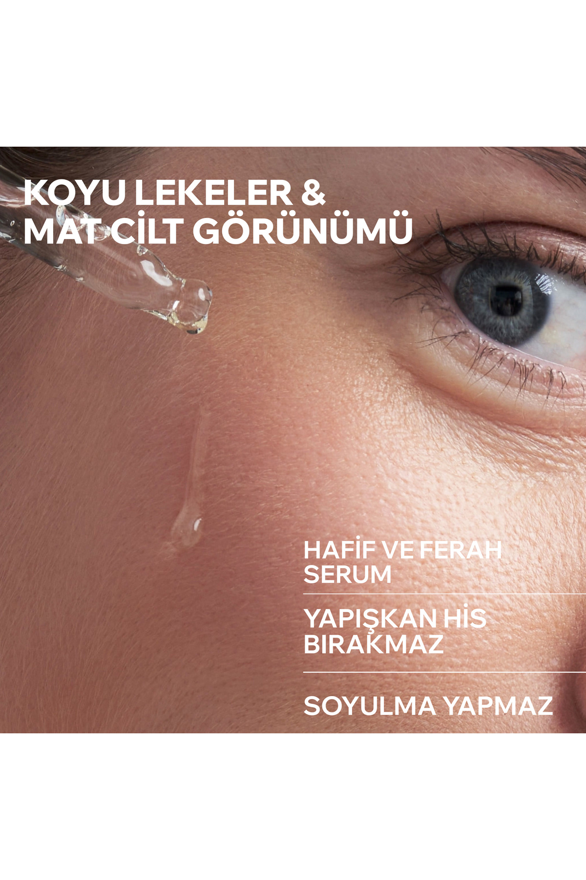 DEPIDERM Leke Karşıtı Aydınlatıcı Serum 30 ml — D80768 — تصویر 3 از 8