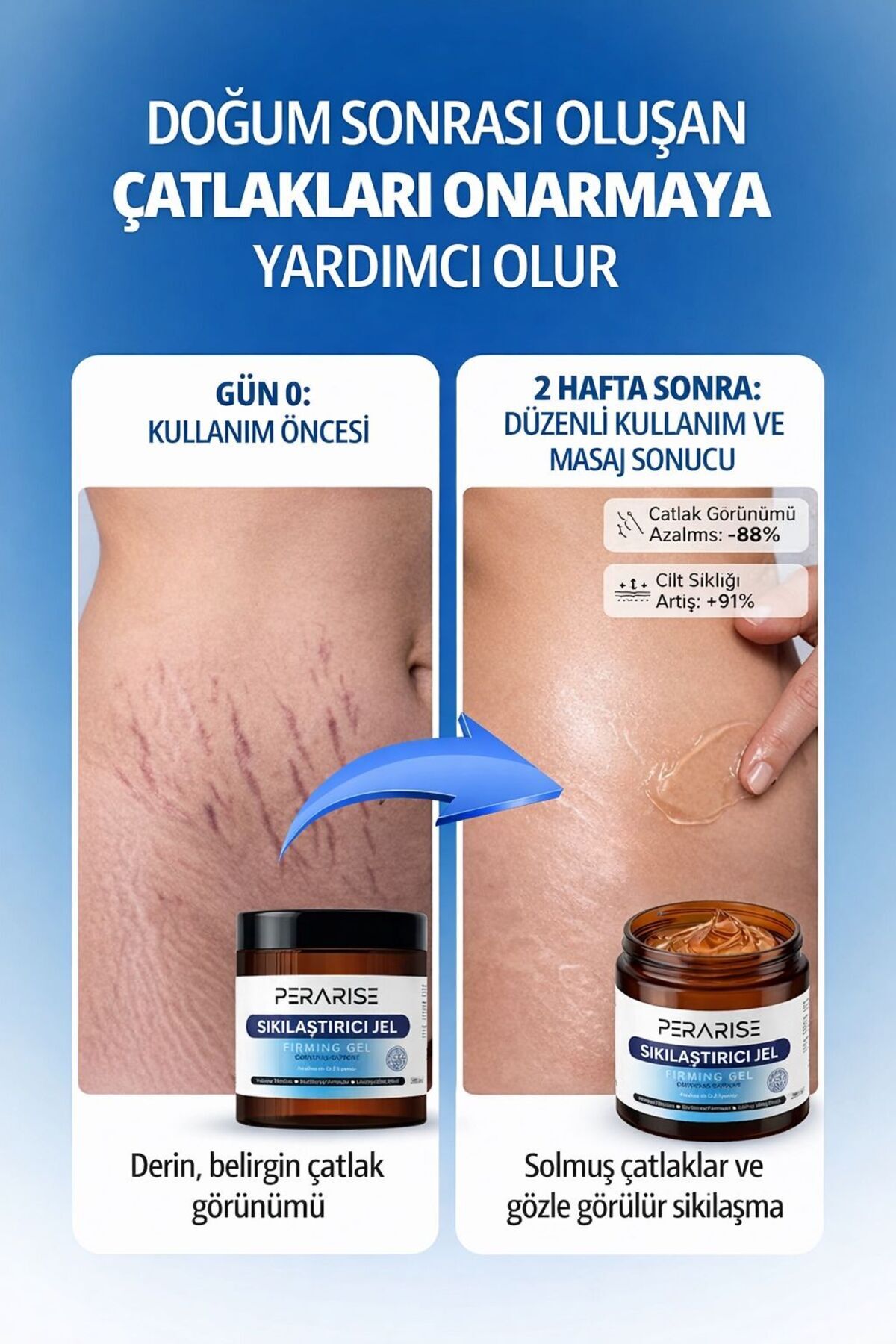 İnceltîcî Sıkılaştırıcı Selülit Jeli - çatlak giderici Yoğun Toparlayıcı Vücut Bakım Kremi 250 Ml — İnceltici5 zayıflama9 yağ yakıcı — تصویر 4 از 5