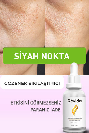 Devida Siyah Nokta Gözenek Sıkılaştırıcı Vivo Series A210