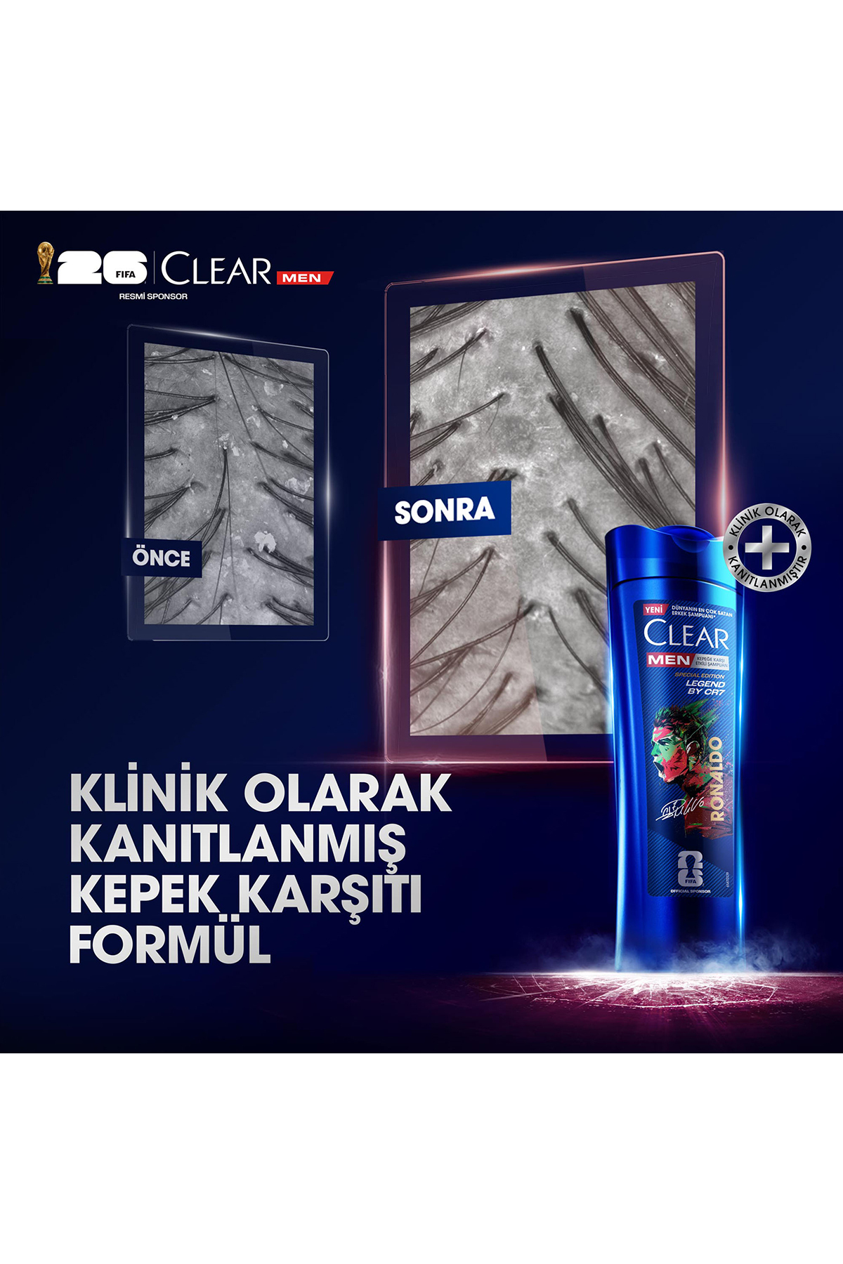 Men Kepeğe Karşı Etkili Şampuan Legend by CR7 350 ml x3 — SET.UNİ.2788 — تصویر 5 از 9