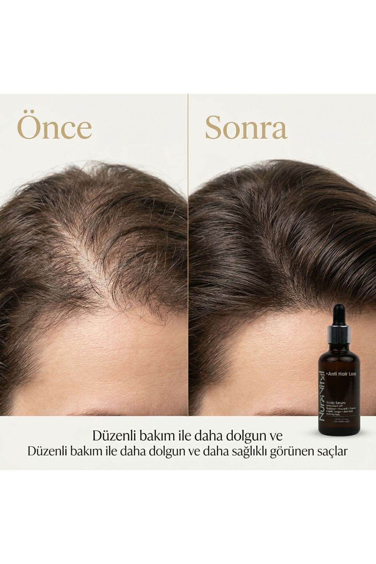Saç Dökülme Karşıtı Scalp Serum 50 ml | Saç Kökü Güçlendirici Bakım Serumu — NV-SS-01-50 — تصویر 5 از 8