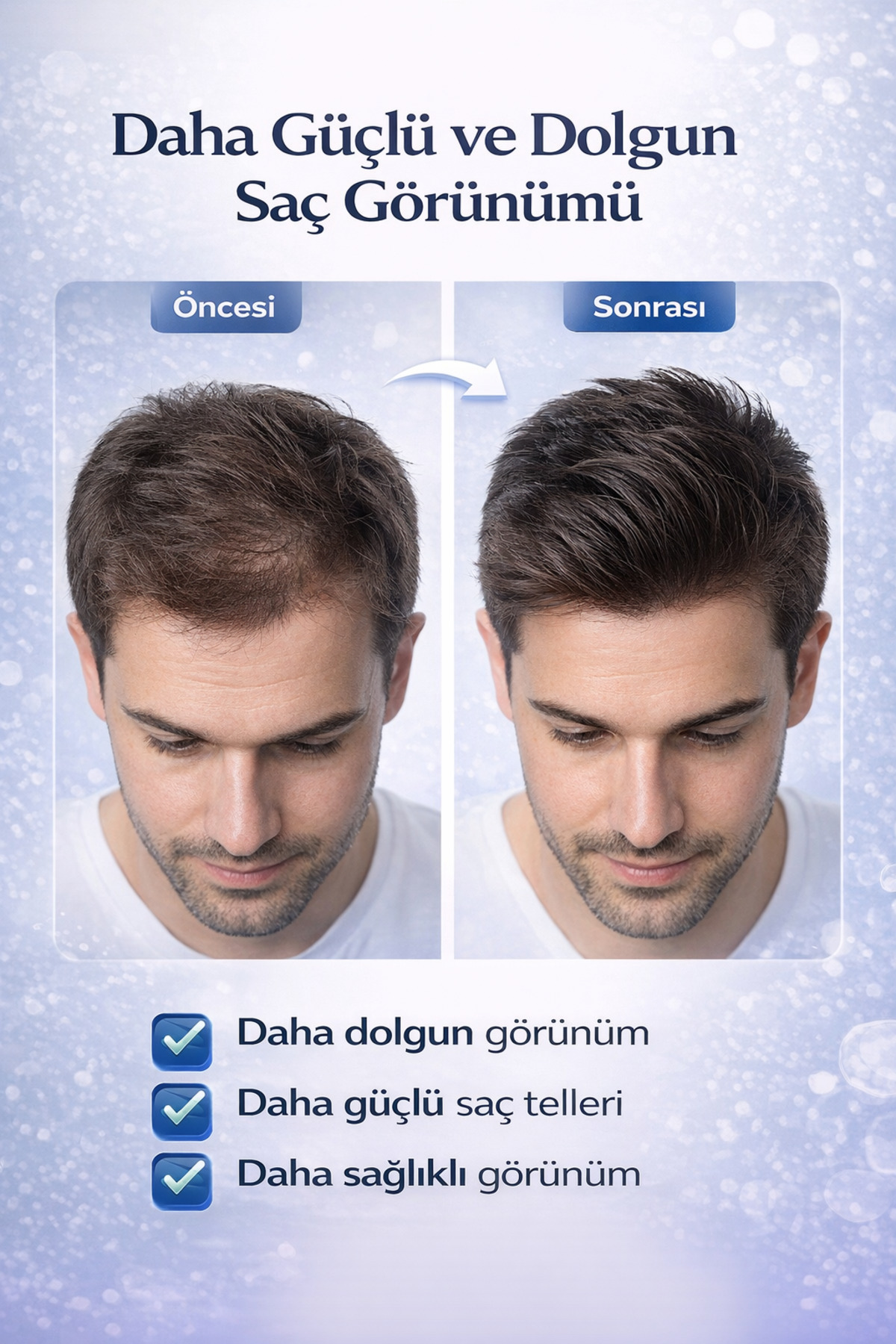 Erkek Saç Dökülme Karşıtı Yoğun Bakım Seti - Güçlendirici ve Besleyici — GM-ERK-DKS-SET01 — تصویر 5 از 7