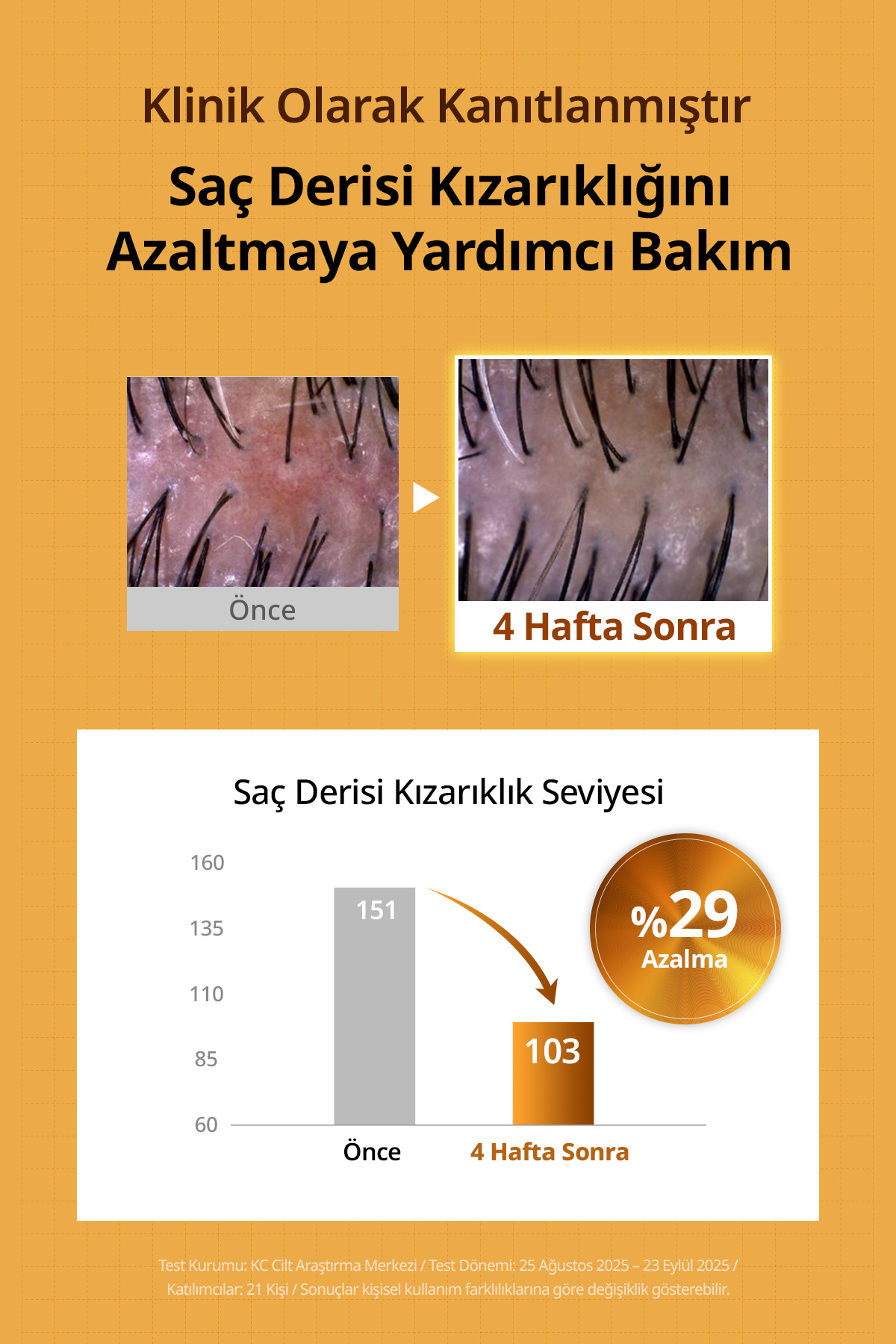 Saç Dökülmesi Karşıtı Ferahlatan Köklere Hacim Sunan Tonik Beer Yeast Extra Root Volume Tonic — 9233 — تصویر 5 از 9