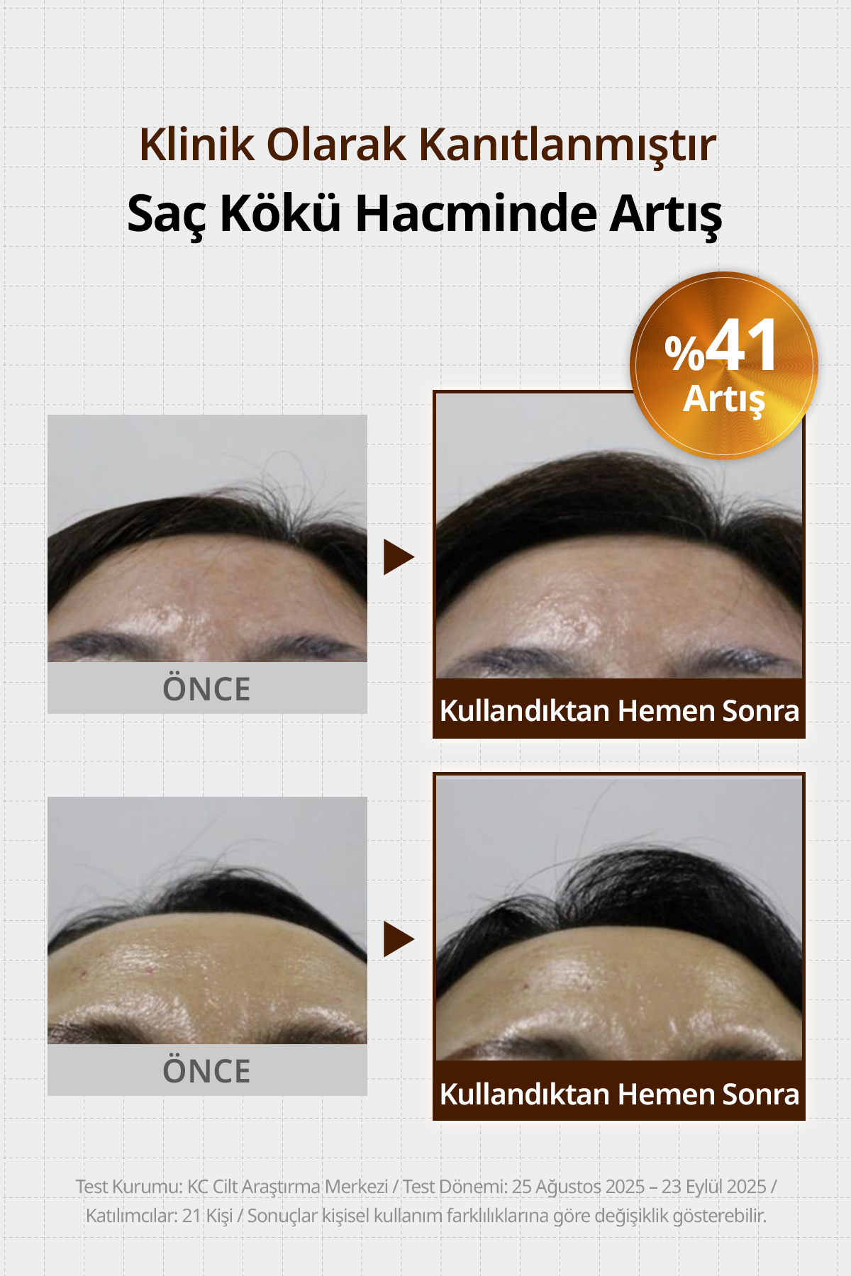 Saç Dökülmesi Karşıtı Ferahlatan Köklere Hacim Sunan Tonik Beer Yeast Extra Root Volume Tonic — 9233 — تصویر 4 از 9