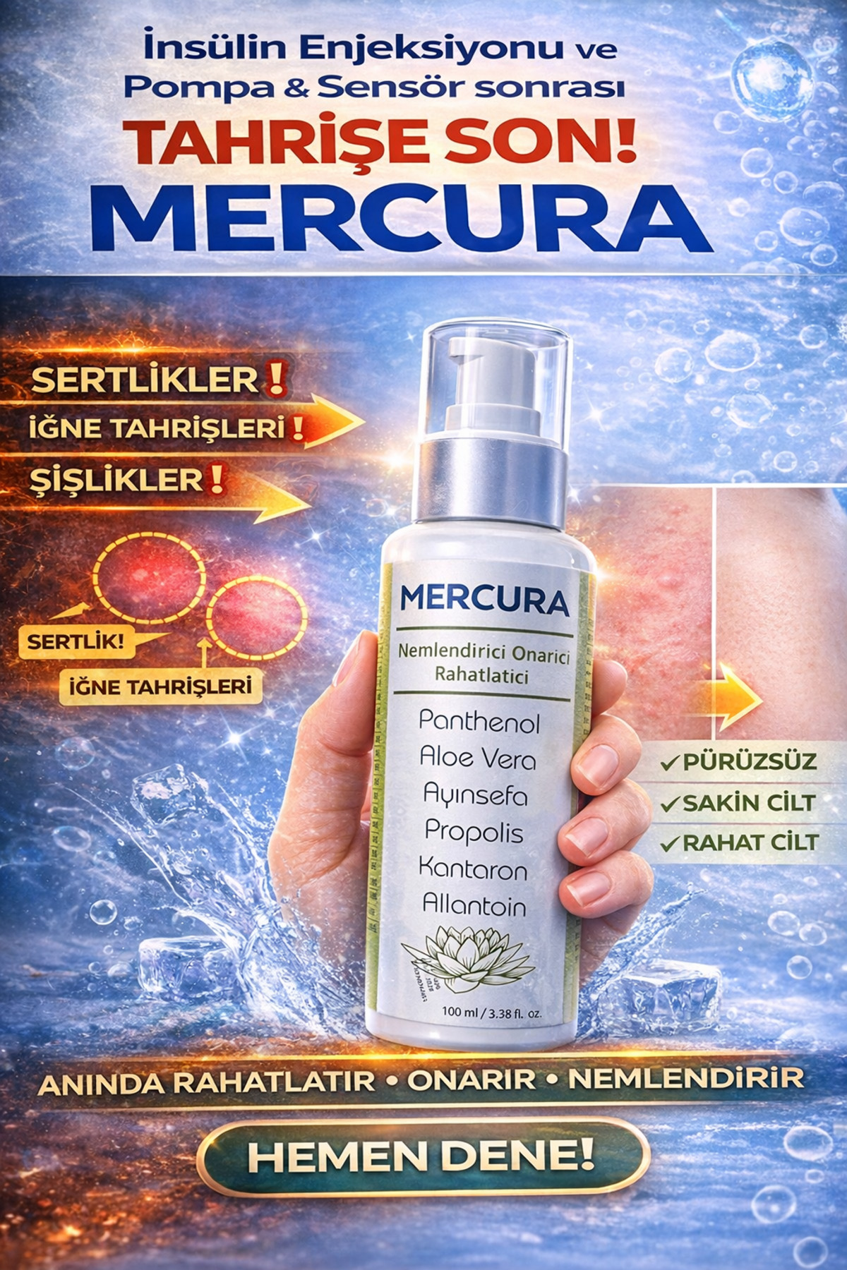 Enjeksiyonu,Pompa,Sensör sonrası rahatlatıcı onarıcı nemlendirici krem — merckrem — تصویر 4 از 4