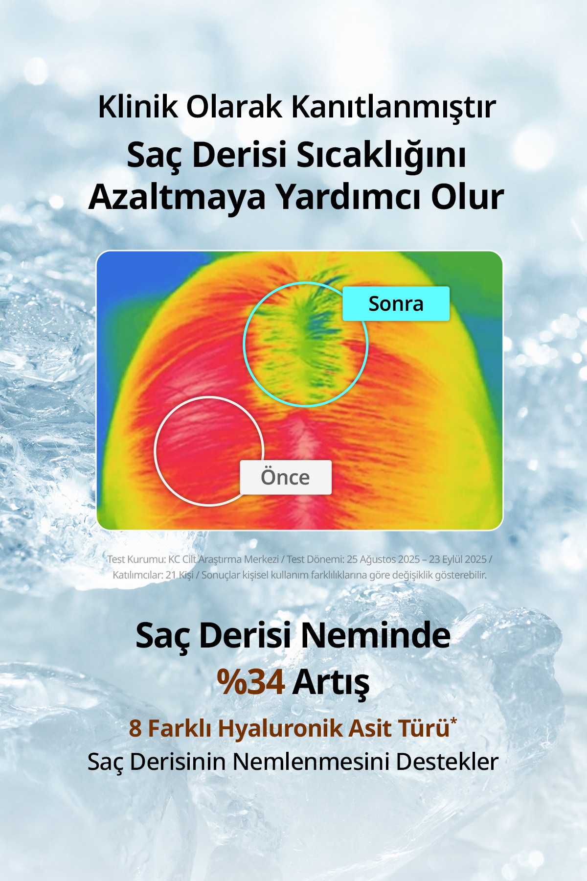 Saç Dökülmesi Karşıtı Ferahlatan Köklere Hacim Sunan Tonik Beer Yeast Extra Root Volume Tonic — 9233 — تصویر 6 از 9