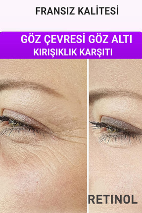 Devida Retinol Göz Çevresi Alın Çizgisi Kırışıklık Karşıtı Serum Xella Series...