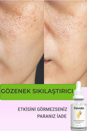 Devida Siyah Nokta Gözenek Sıkılaştırıcı Vivo Series A210