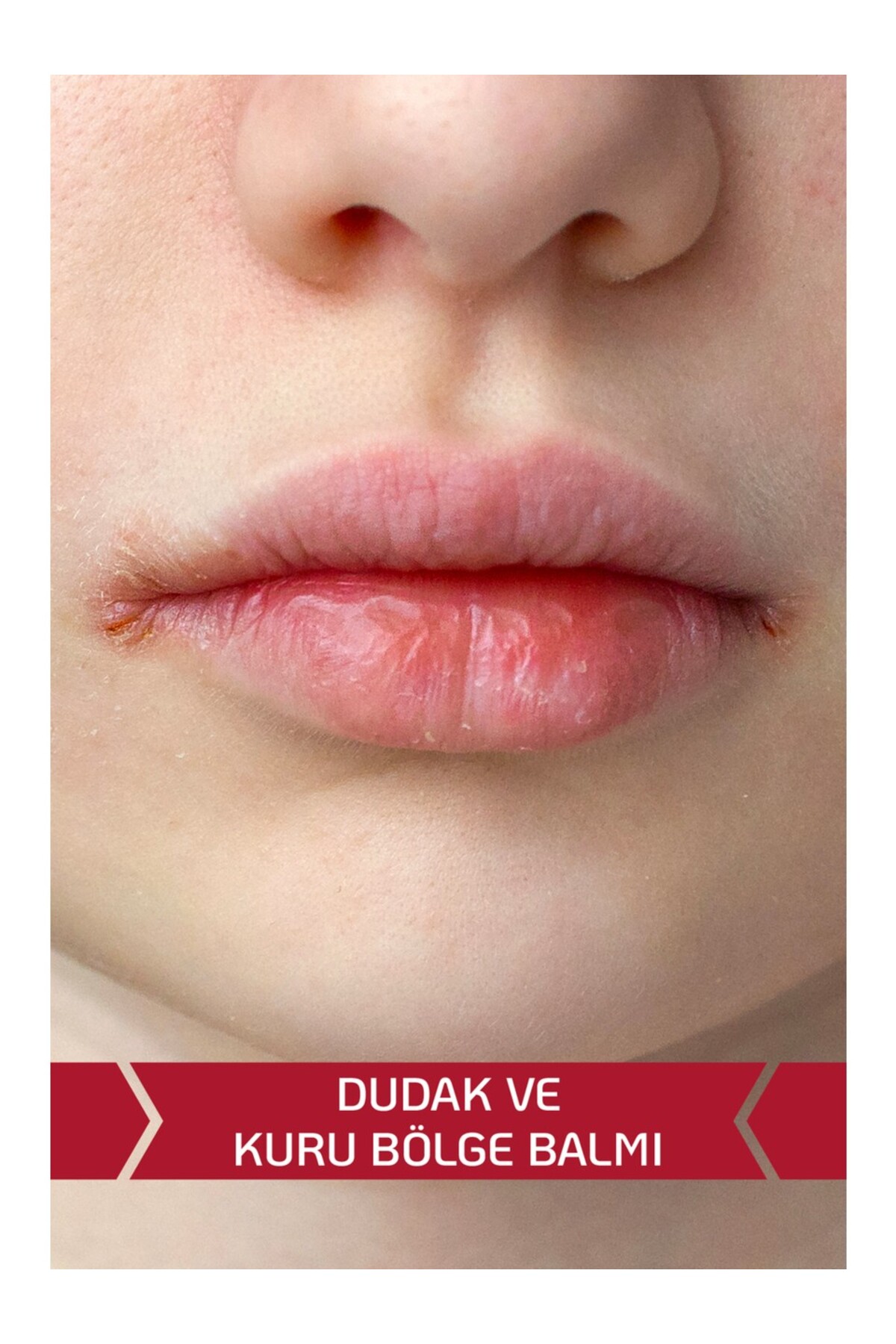 Kuru ve Hassas Ciltler için Klinik Krem 250 ml ve Dudak Balmı 30 ml — DECUBAL/SET/0001 — تصویر 4 از 8