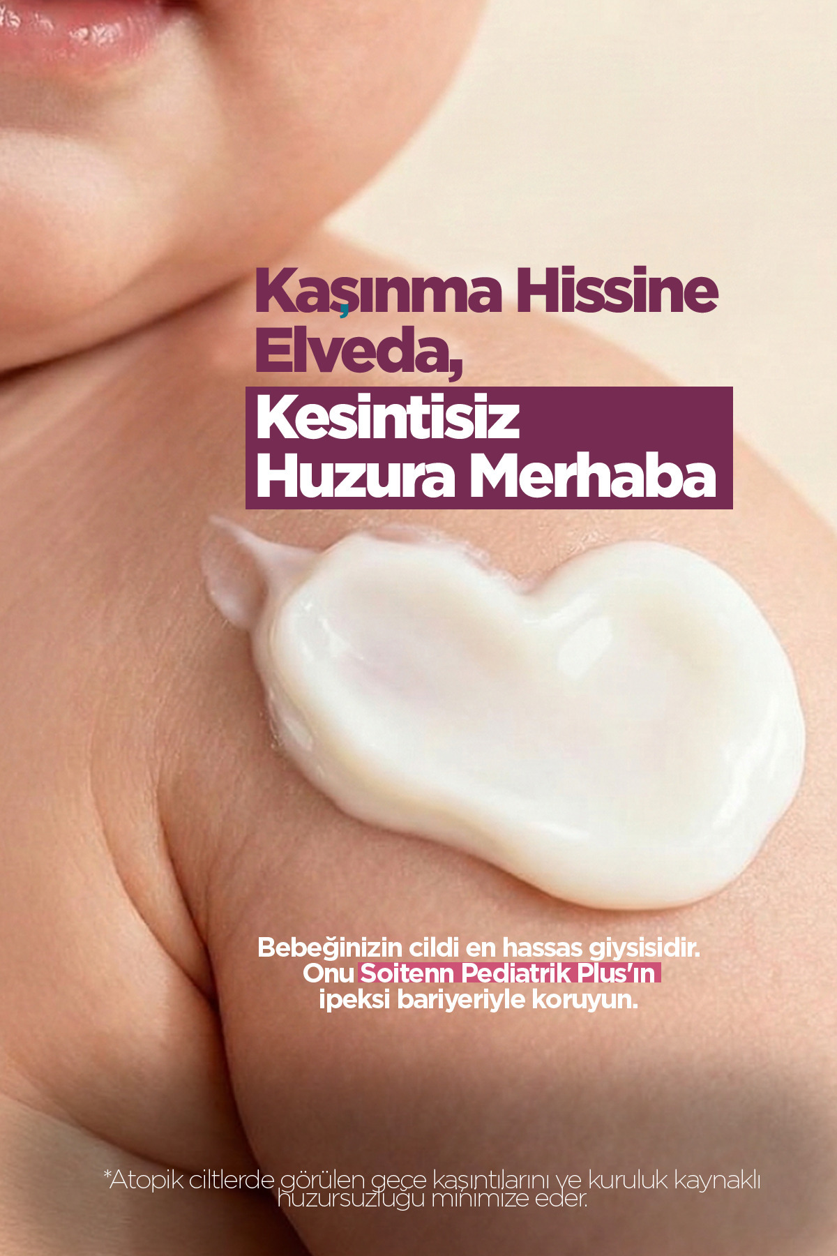 SOİTENN Pediatrik Plus Bebek Çocuk Hassas Cilt Nemlendirici Koruyucu Pişik Kremi 200 Ml fotoğrafı 4 (önizleme)