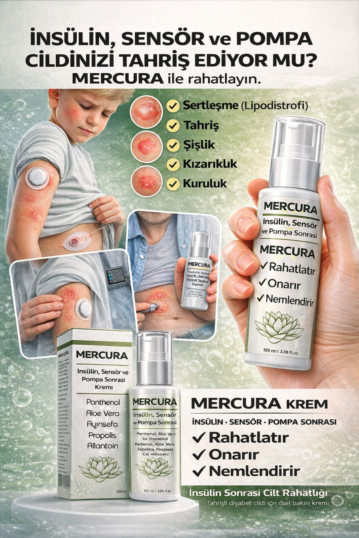 Enjeksiyonu,Pompa,Sensör sonrası rahatlatıcı onarıcı nemlendirici krem — merckrem