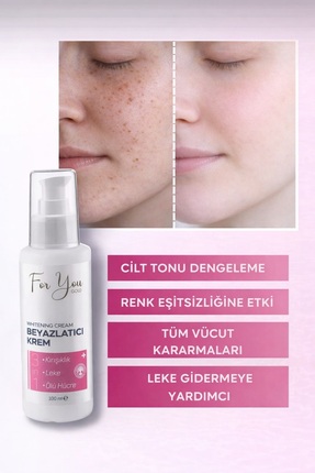 For You Gold Cilt Beyazlatıcı Krem (Kararma Karşıtı - Ton Eşitleyici - Renk A...