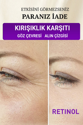 Devida Retinol Göz Çevresi Alın Çizgisi Kırışıklık Karşıtı Serum Xella Series...
