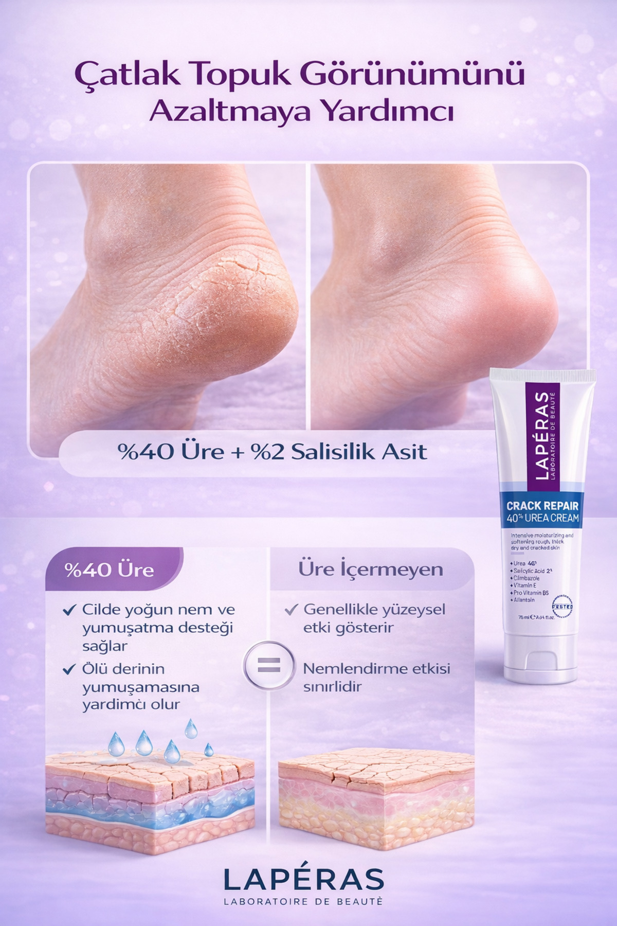 %40 Üre Ayak ve Topuk Çatlak Kremi | Yoğun Nemlendirici, Nasır, Koku Karşıtı | Kuru Sertleşmiş Ciltler İçin | %2 Salisilik Asit 75 ml — LPS001511161 — تصویر 4 از 9