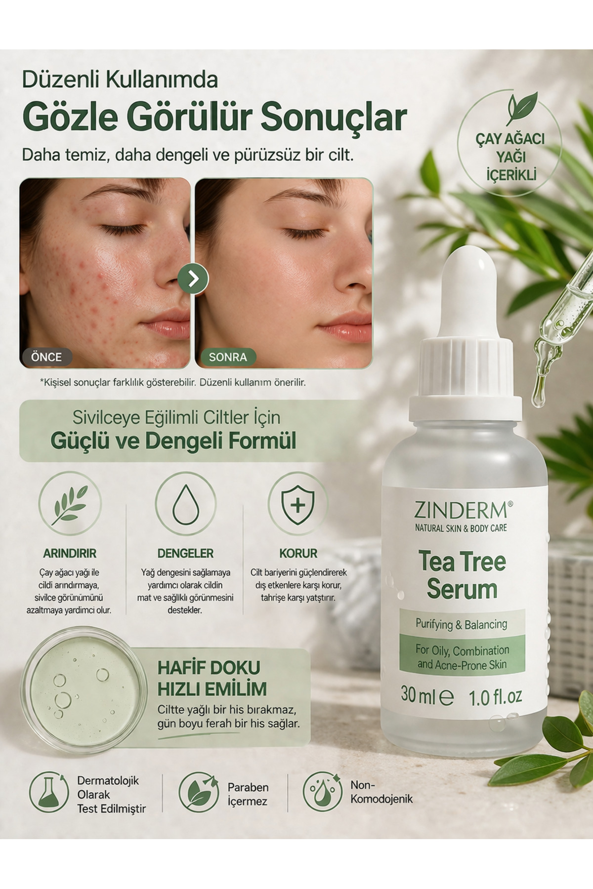 Akne Karşıtı Çay Ağacı Yağı Serum, Salisilik Asit, Niacinamide, Hyaluronik Asit Çay Ağacı Yağı Cilt Serumu 30 ML — zindermttoserum — تصویر 3 از 4
