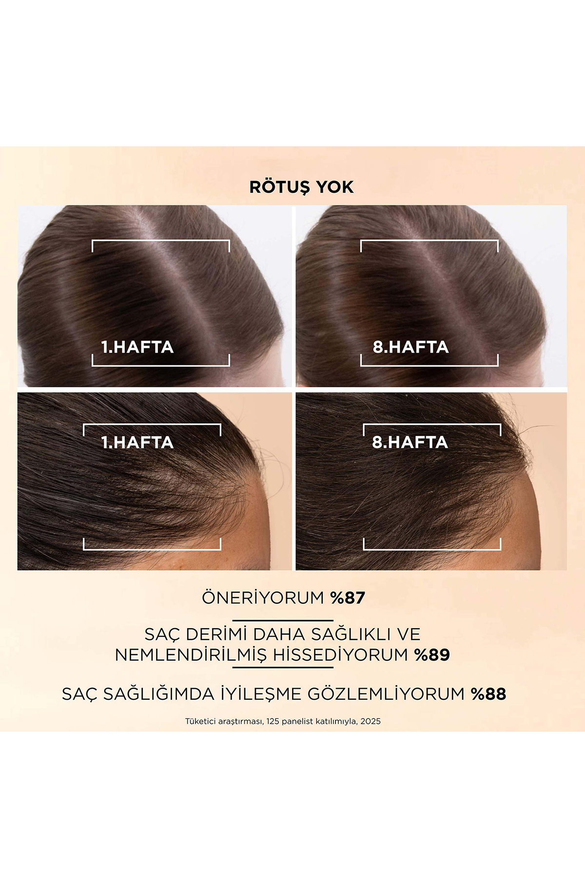 Grow Abundant Saç Dökülmesine Karşı Pro-V Kompleksi + Niasinamid İçeren Saç Derisi Serumu 60ml — 8006530060721 — تصویر 3 از 7