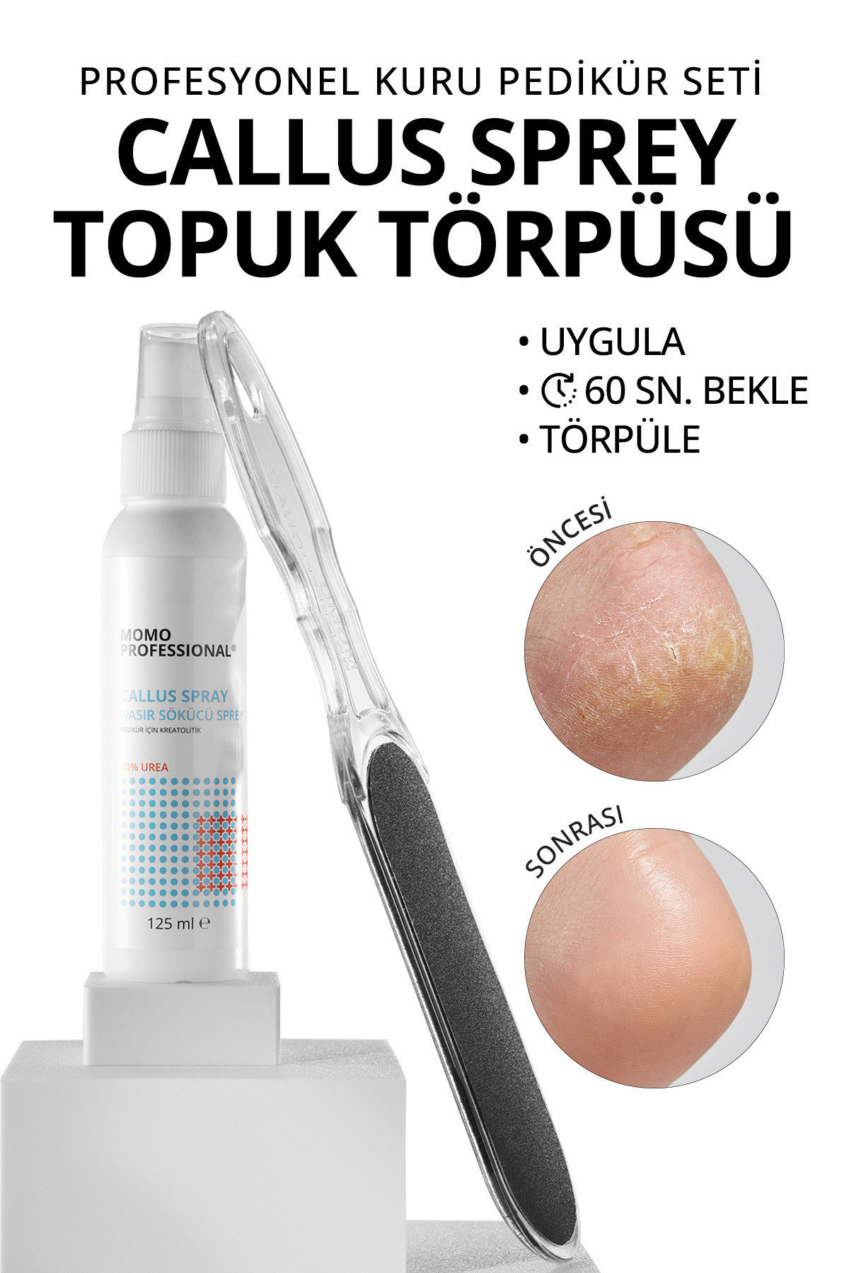 MOMO professional 0 ست پدیکور دو تکه Advantageous: اسپری پاک کننده پینه پا ۱۲۵ میلی لیتر و سوهان پاشنه ۱۰۰/۱۸۰ Grit — بسته ۵