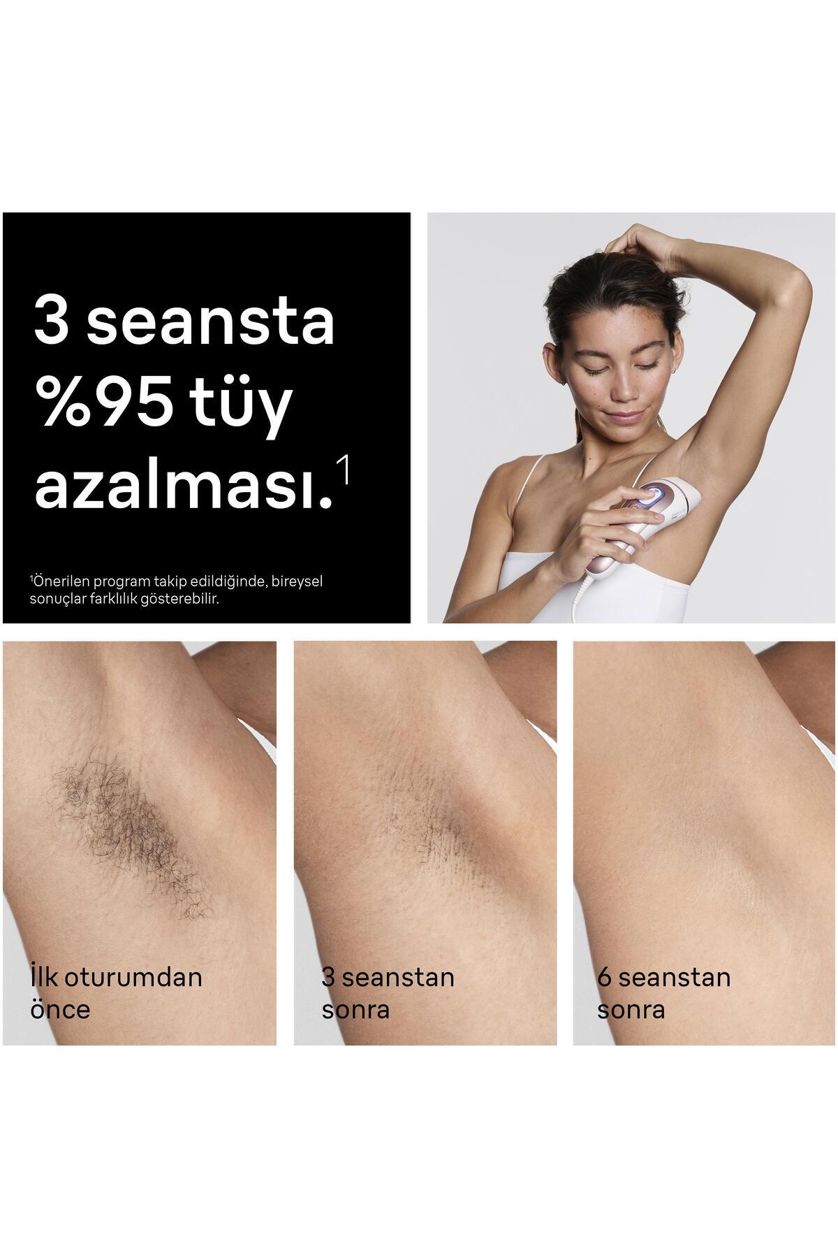 IPL Skin i·expert، دستگاه لیزر خانگی حذف مو، با اپلیکیشن، همراه با کیف، Gillette Venus، 2 سری، PL7211