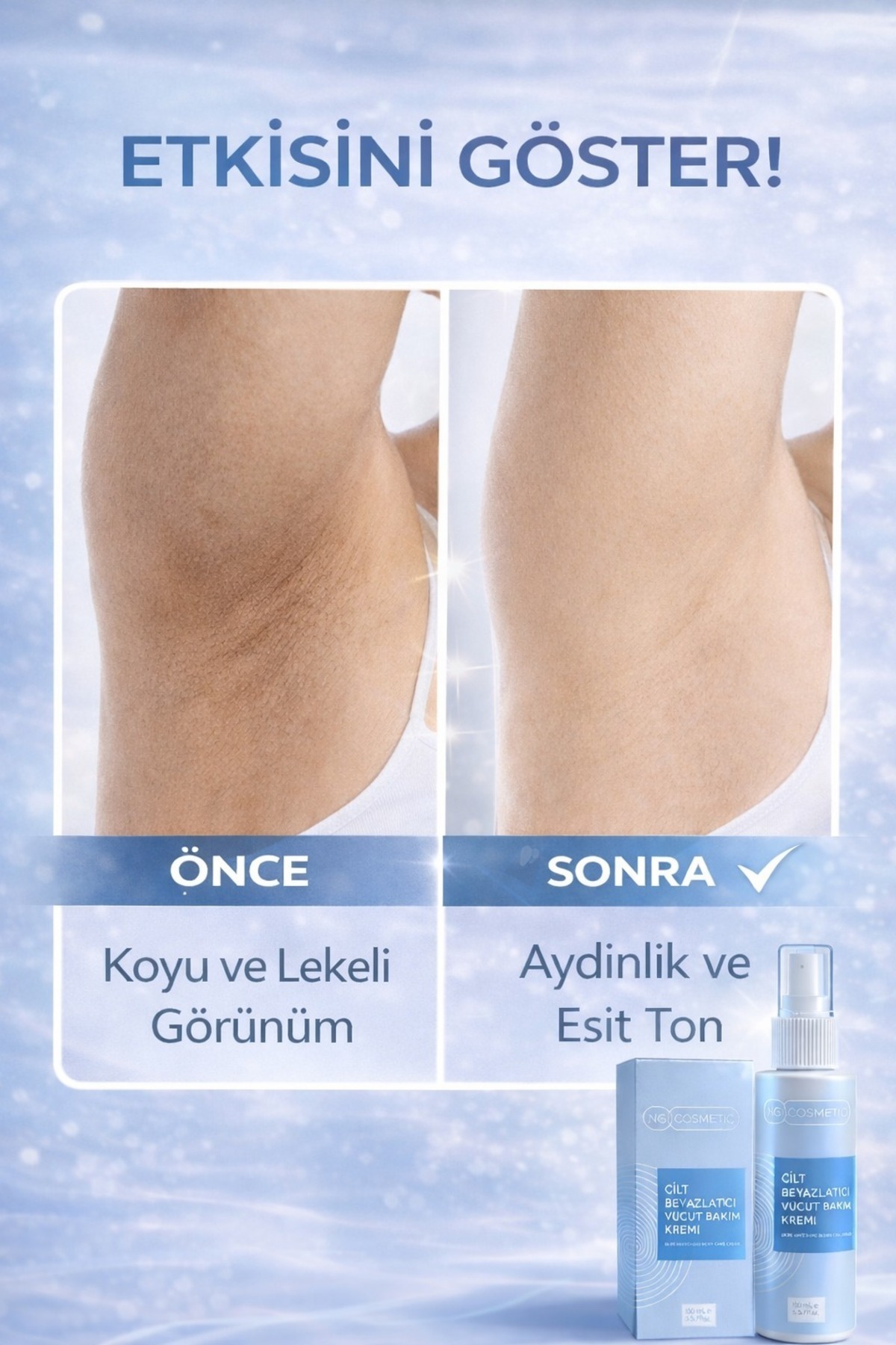 NG Kozmetik Arbutin ve Meyan Kökü Özlü Diz,Dirsek, Koltukaltı, Genital Bölge Beyazlatıcı Cilt Kremi 100 ML - Fiyatı, Yorumları