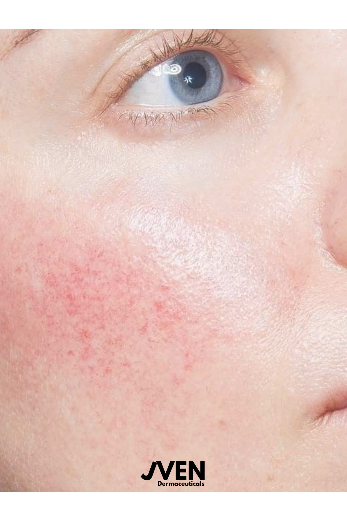 Barrier Repair Cream - Kuru, Hassas ve Bariyeri Zayıflamış Ciltler İçin Bariyer Onarıcı Krem — BRC1 — تصویر 3 از 5