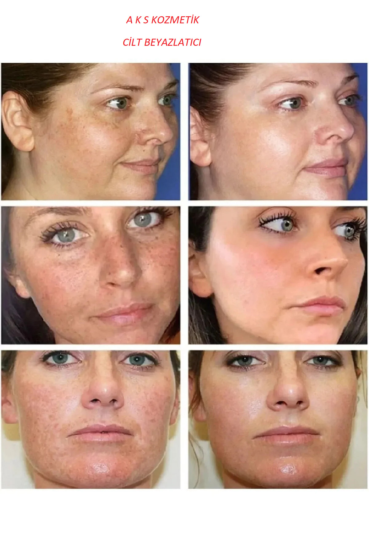 Beyazlatıcı Krem Sabun Ve Serum Seti 3'lü Set — 23454534354 — تصویر 3 از 3