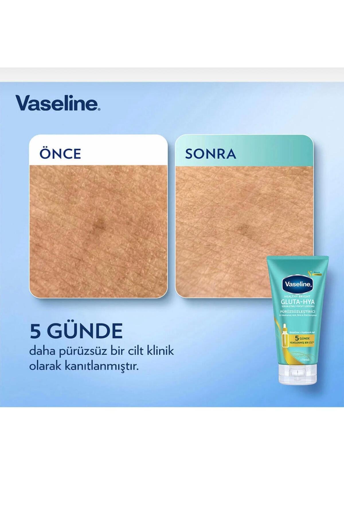 Gluta-hya Niyasinamid Serum Etkili Vücut Losyonu Pürüzsüzleştirici 170 ml — vazelin — تصویر 4 از 4