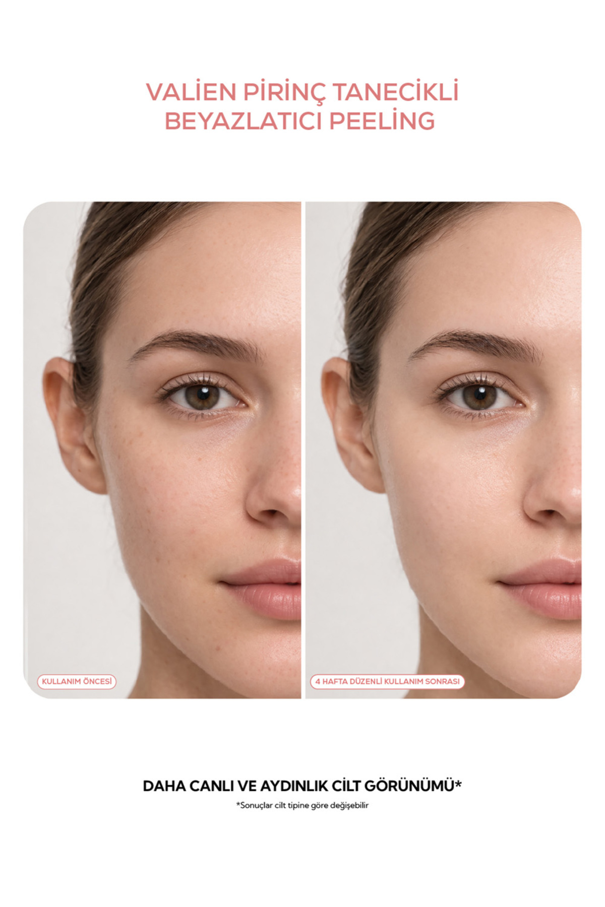 Pirinç Tanecikli Beyazlatıcı Peeling Aydınlatıcı Cilt Tonu Eşitleyici Maske - 150ml — 00000Valien6 — تصویر 4 از 6