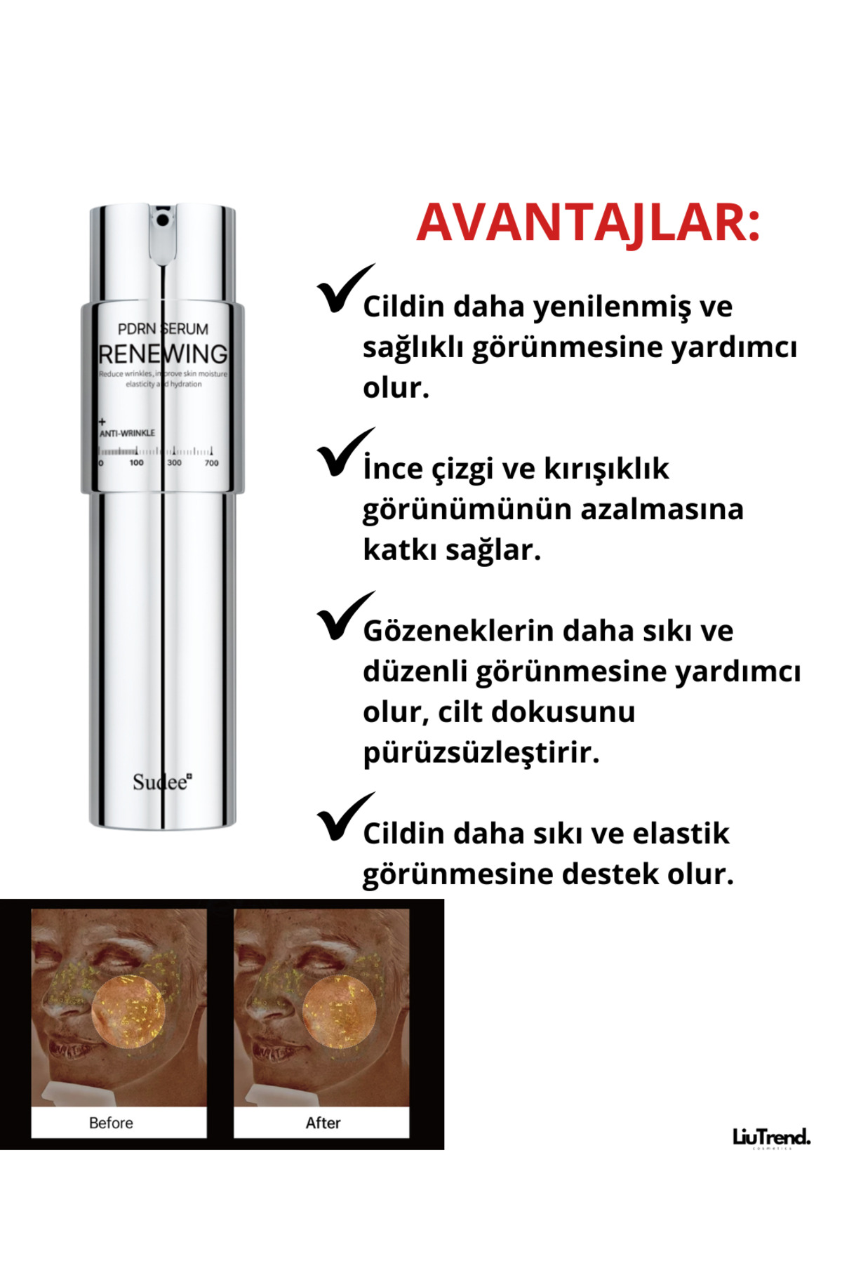 سرم جوان کننده ۱۰۰ میلی لیتری Pdrn و سرم تقویت کننده میکرونیدلینگ Pdrn — SU011 — تصویر 4 از 8