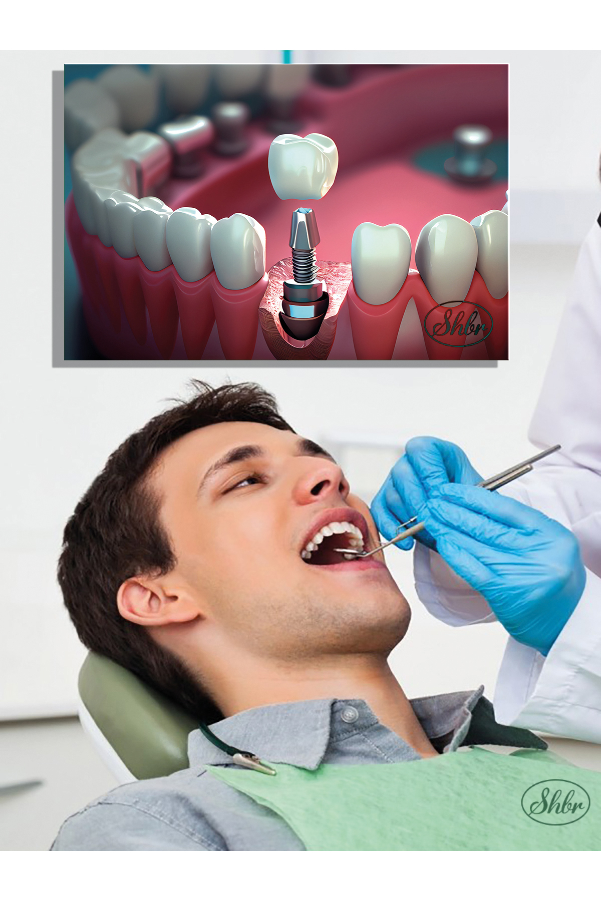 Single, Horizontal, Canvas, Decorative, Wall, Table , Oral and Dental Health, Dentist, Implant