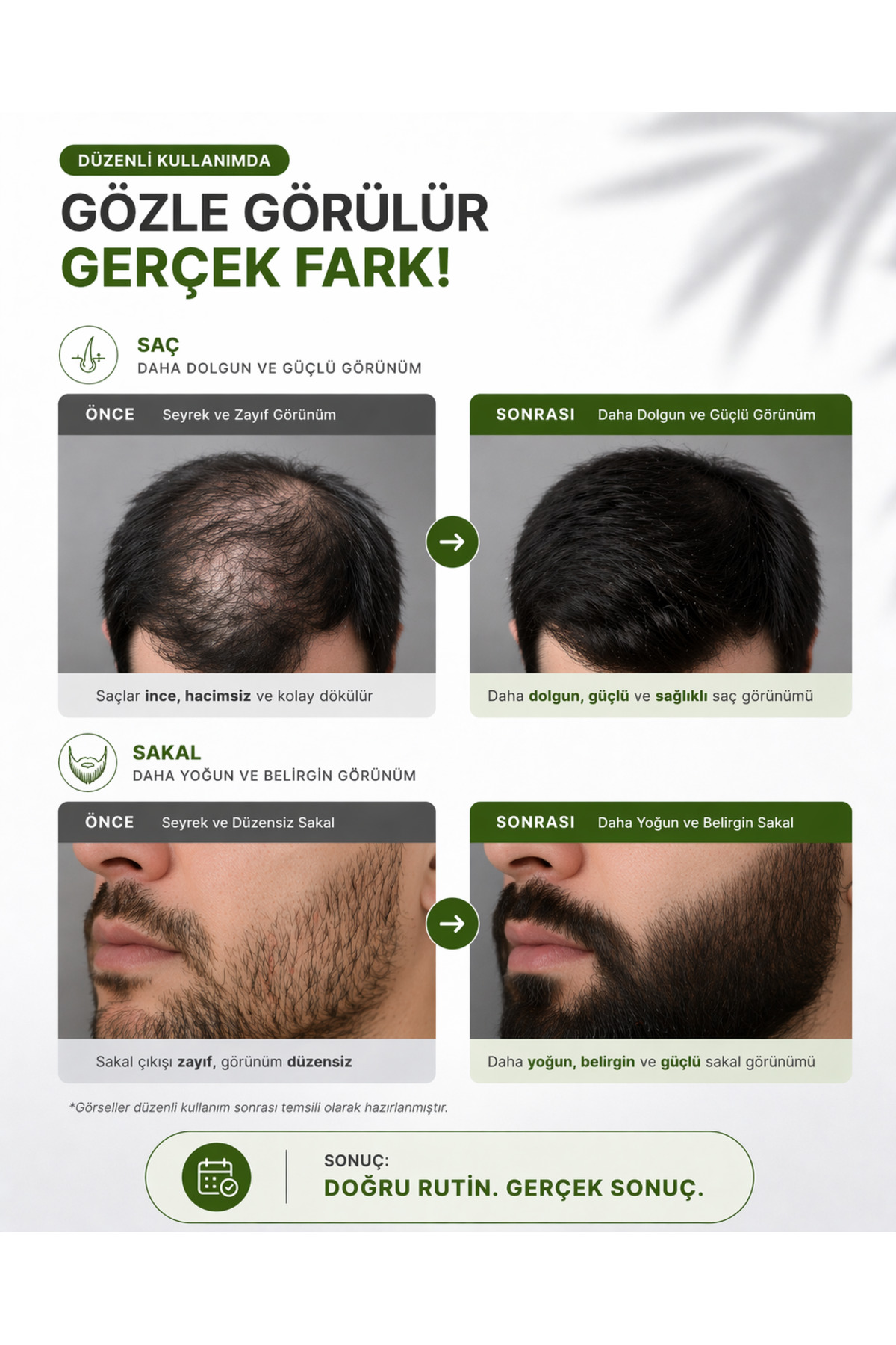 Saç ve Gürleştirme Bakım Seti – Dermaroller, Saç Sakal Serumu ve Biberiye Suyu — set9 — تصویر 6 از 8