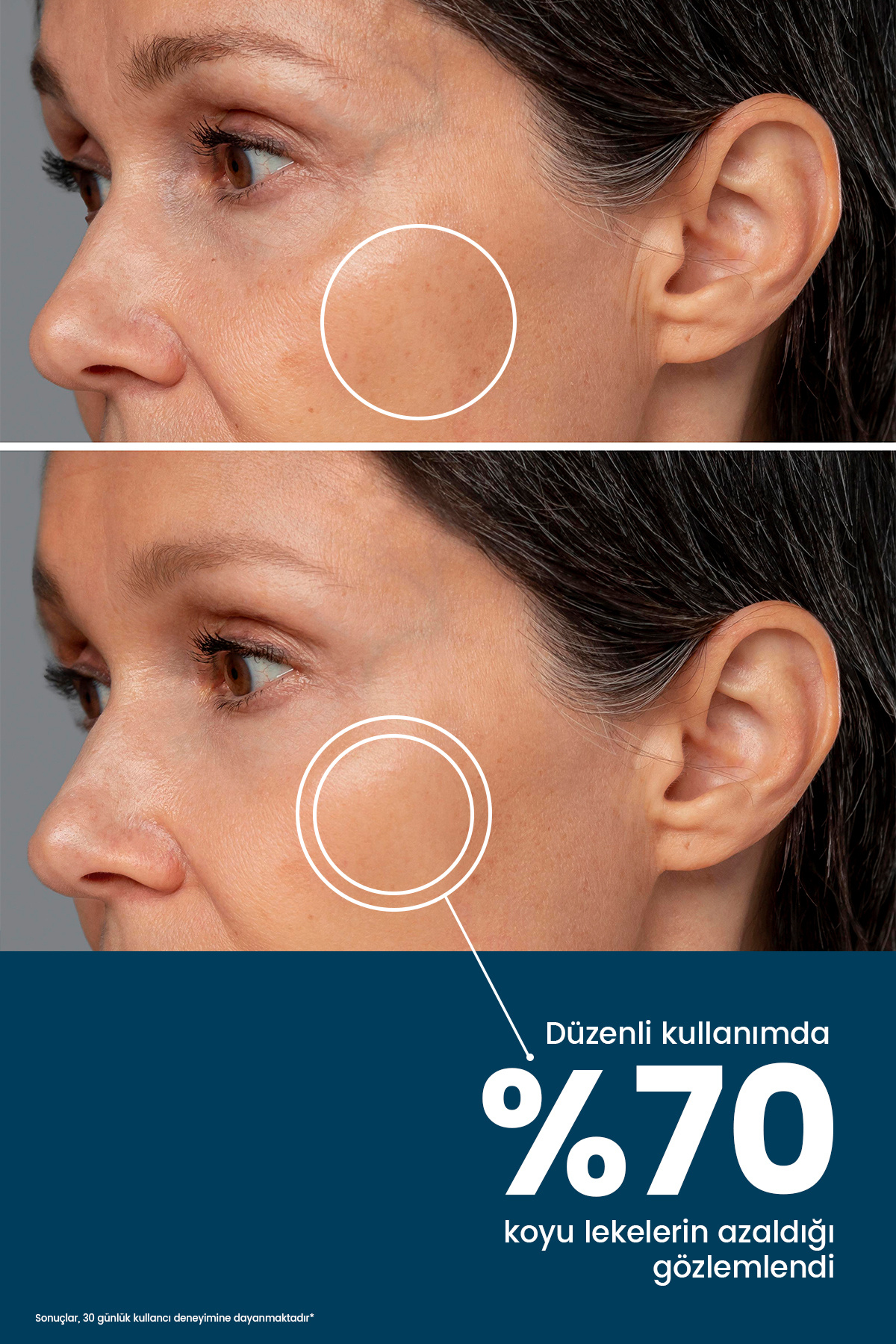 Arbutin + Vitamin C Leke Karşıtı Cilt Serumu - Cilt Tonu Eşitleyici, Aydınlatıcı — RYSSRM01 — تصویر 3 از 9