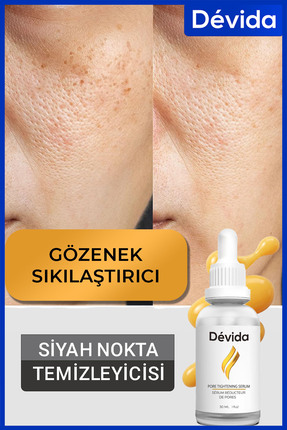 Devida Siyah Nokta Gözenek Sıkılaştırıcı Vivo Series A210