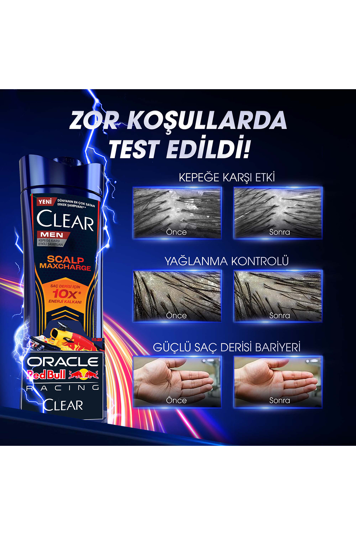 Men Kepeğe Karşı Etkili Şampuan Scalp Maxcharge Oracle Red Bull Racing 330 ml x3 — SET.UNİ.11140 — تصویر 8 از 9