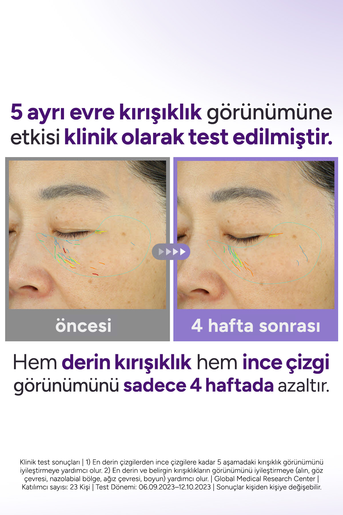 360º Shot PDRN Active Serum / Toparlayıcı Somon Dna Serumu 50ml — TYCZR1JT2N172969212143551 — تصویر 6 از 8