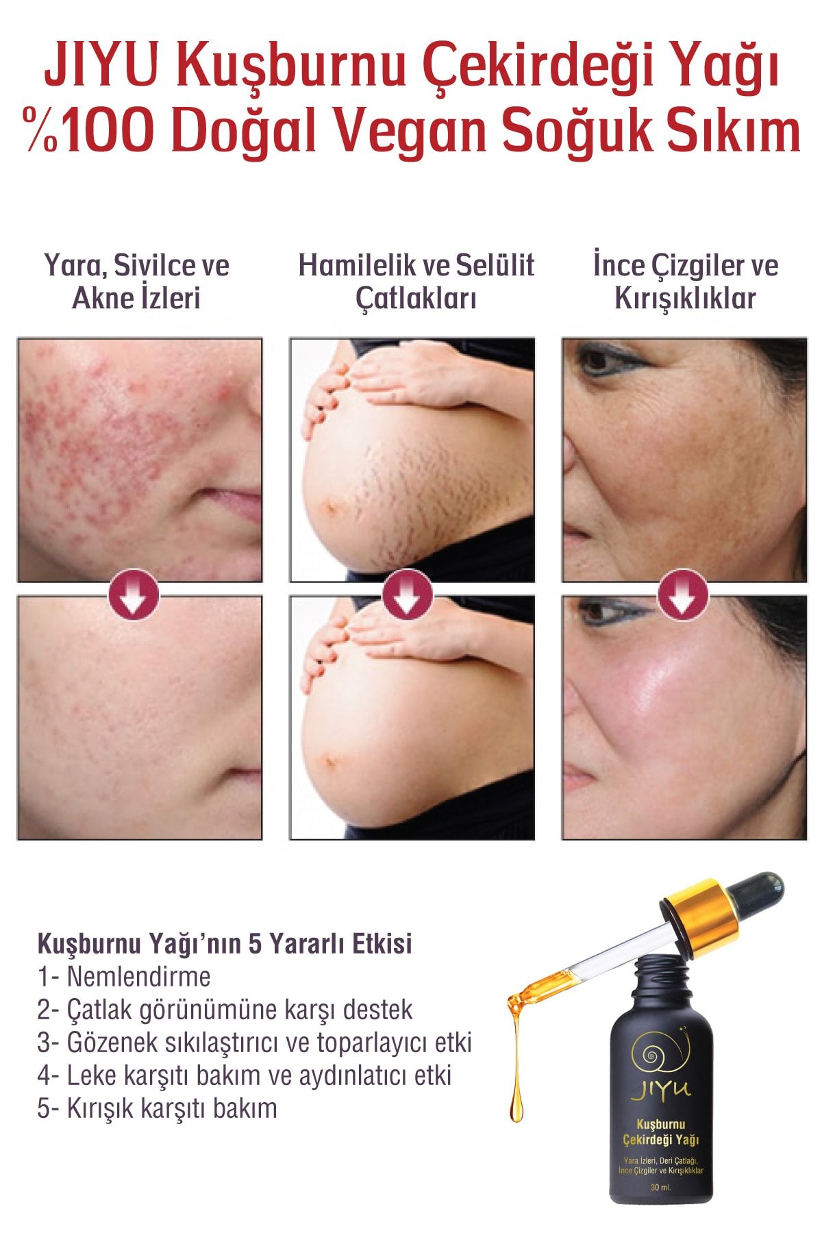 JIYU-Rosehip Seed Oil 100% Natural Anti-Aging, Anti-Wrinkle, Anti-Blemish and Leather Stretch Mark Remover 30 ml 4