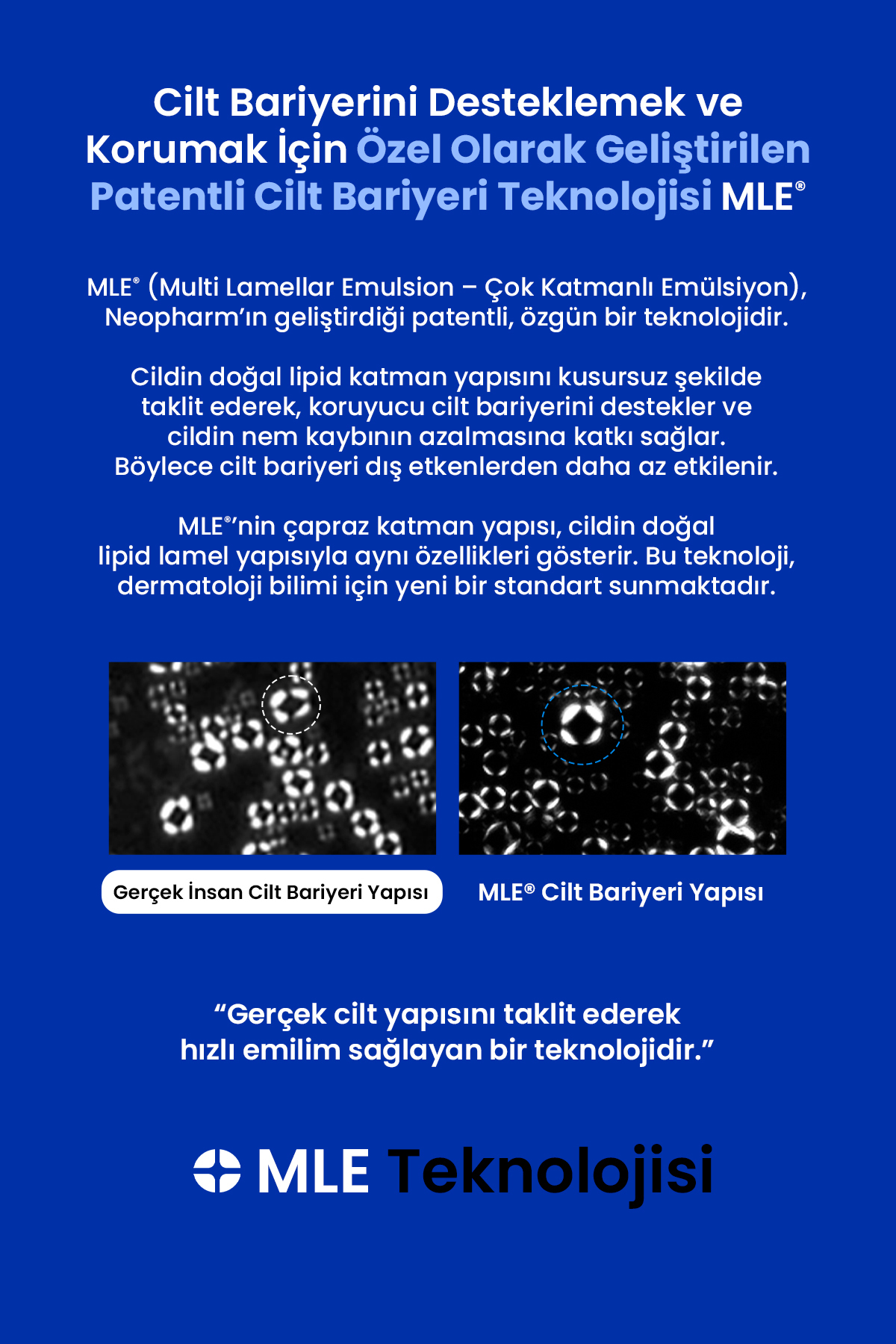 Hassaslaşmış Cilt Bariyerini Destekleyen Yoğun Nemlendirici Krem REALBARRIER Extreme Cream Original — RB02 — تصویر 4 از 9